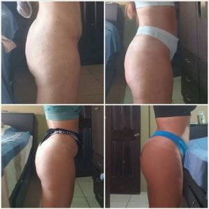 0 a 3 meses